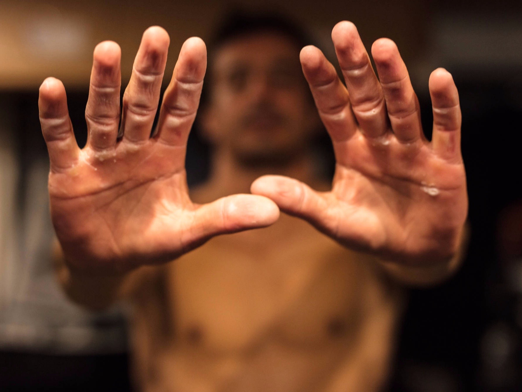 Francisco Lufinha damaged hands